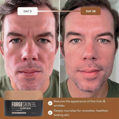 Forge Skin Beef Tallow Balm Skin Moisturizer for Men, Anti Aging Wrinkle Defense - Face & Body Skincare Hydration Cream, 100% Grass-Fed Lotion, Paraben-Free, Helps Minimize Look of Fine Lines, 1.7 oz